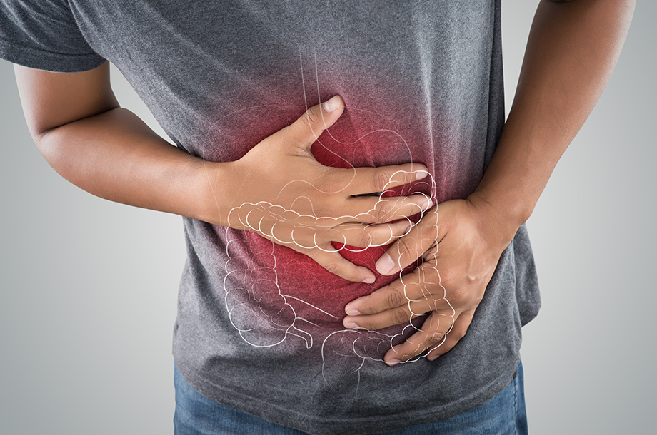 What is colitis and its symptoms?