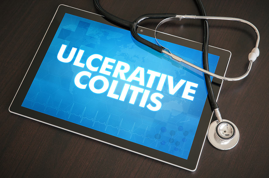 What causes ulcerative colitis disease?