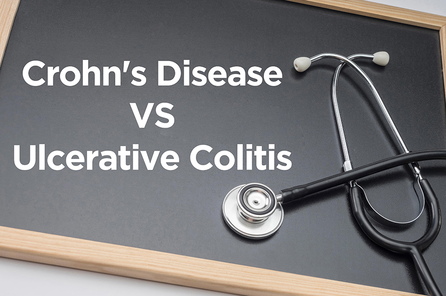 difference between Crohn's Disease and Ulcerative Colitis