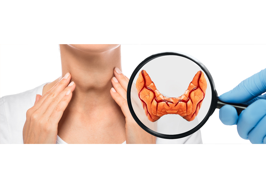 Natural Remedies To Cure Thyroid At Home