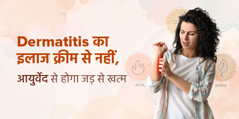 Dermatitis का इलाज क्रीम से नहीं, आयुर्वेद से होगा जड़ से खत्म