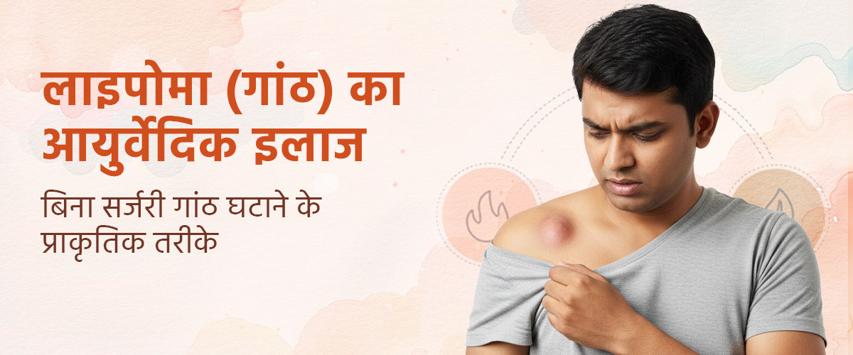 लाइपोमा (गांठ) का आयुर्वेदिक इलाज – बिना सर्जरी गांठ घटाने के प्राकृतिक तरीके