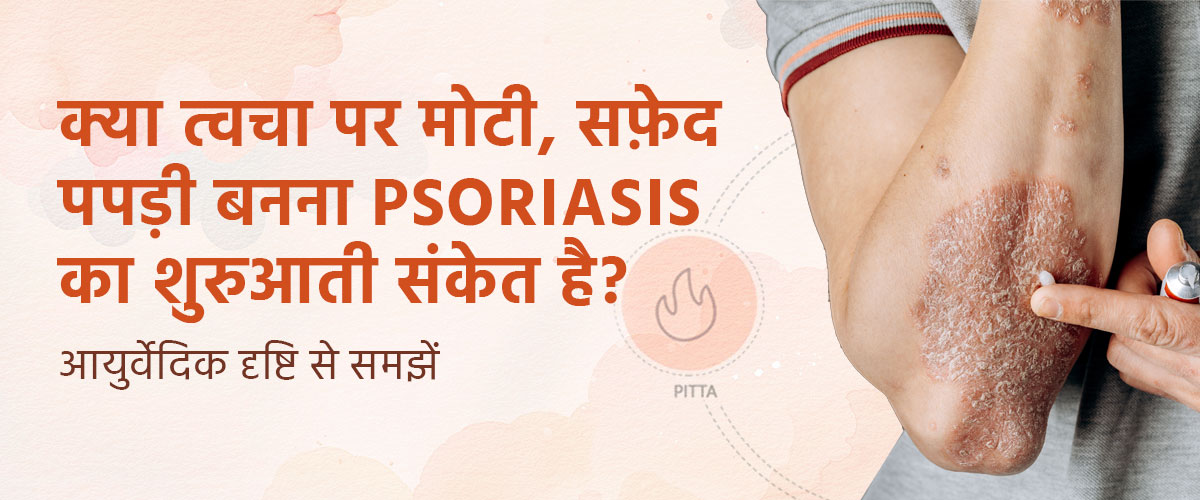 क्या त्वचा पर मोटी, सफ़ेद पपड़ी बनना Psoriasis का शुरुआती संकेत है? आयुर्वेदिक दृष्टि से समझें