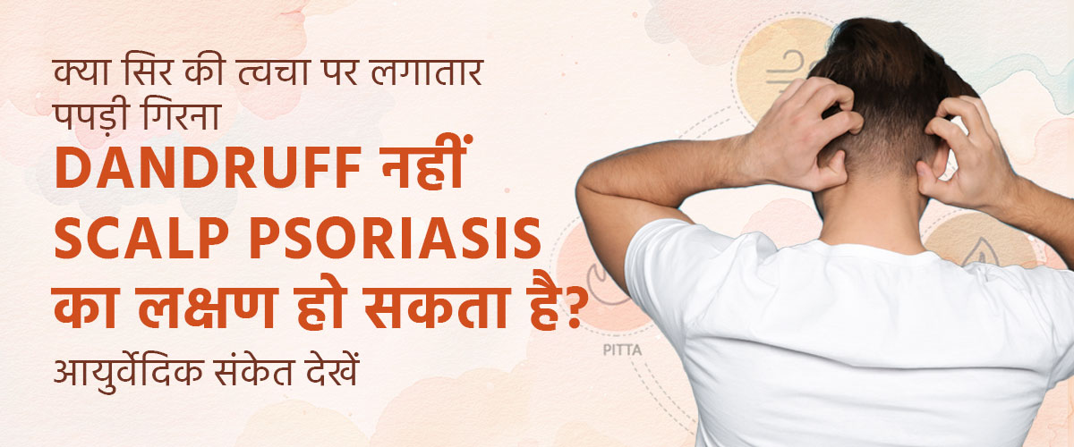 क्या सिर की त्वचा पर लगातार पपड़ी गिरना Dandruff नहीं—Scalp Psoriasis का लक्षण हो सकता है? आयुर्वेदिक संकेत देखें