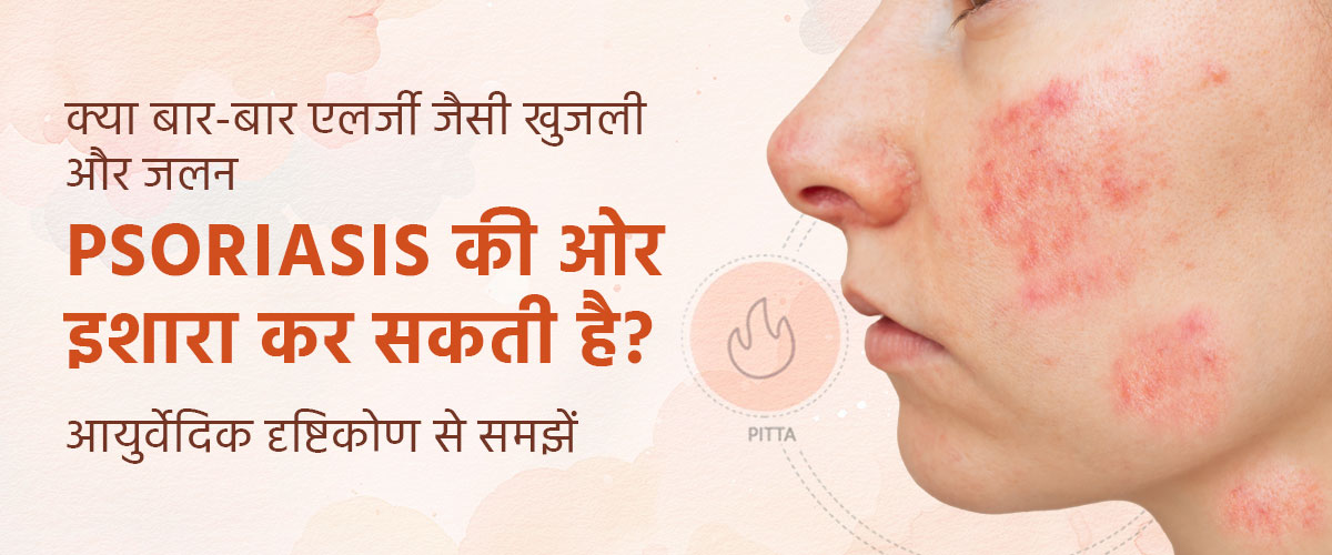 क्या बार-बार एलर्जी जैसी खुजली और जलन Psoriasis की ओर इशारा कर सकती है? आयुर्वेदिक दृष्टिकोण से समझें