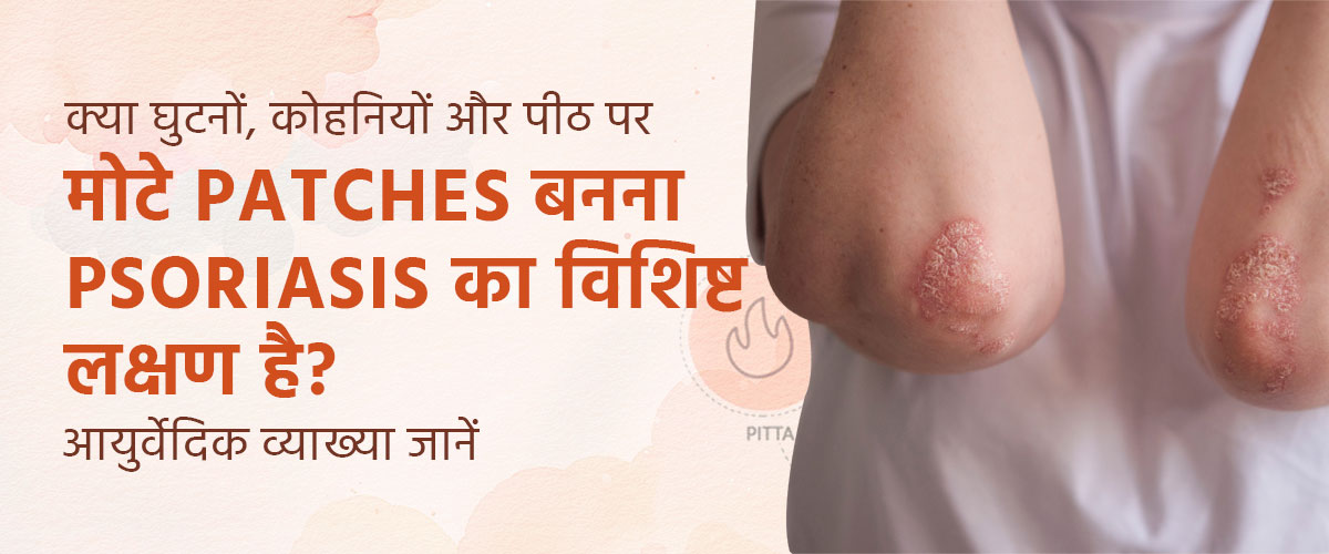 क्या घुटनों, कोहनियों और पीठ पर मोटे patches बनना Psoriasis का विशिष्ट लक्षण है? आयुर्वेदिक व्याख्या जानें