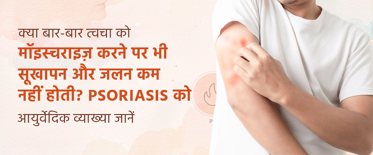 क्या बार-बार त्वचा को मॉइस्चराइज़ करने पर भी सूखापन और जलन कम नहीं होती? Psoriasis को आयुर्वेद की नज़र से समझें