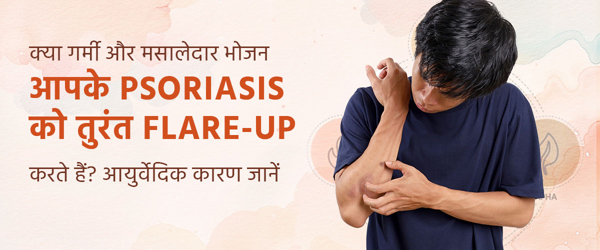 क्या गर्मी और मसालेदार भोजन आपके Psoriasis को तुरंत flare-up करते हैं? आयुर्वेदिक कारण जानें