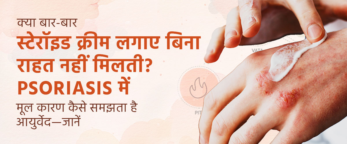 क्या बार-बार स्टेरॉइड क्रीम लगाए बिना राहत नहीं मिलती? Psoriasis में मूल कारण कैसे समझता है आयुर्वेद—जानें
