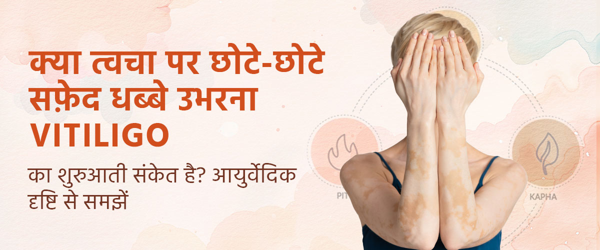 क्या त्वचा पर छोटे-छोटे सफ़ेद धब्बे उभरना Vitiligo का शुरुआती संकेत है? आयुर्वेदिक दृष्टि से समझें