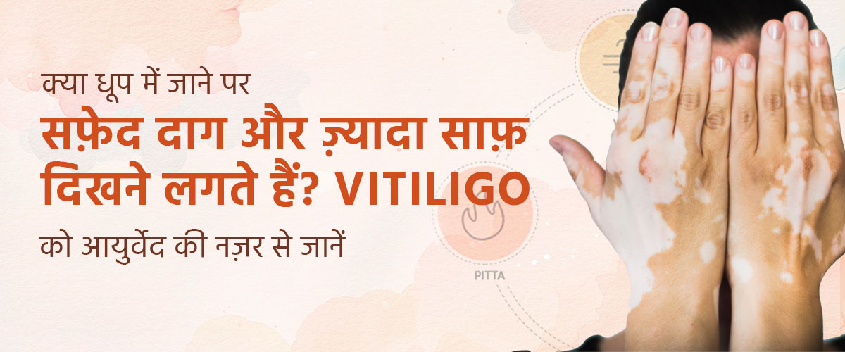 क्या धूप में जाने पर सफ़ेद दाग और ज़्यादा साफ़ दिखने लगते हैं? Vitiligo को आयुर्वेद की नज़र से जानें