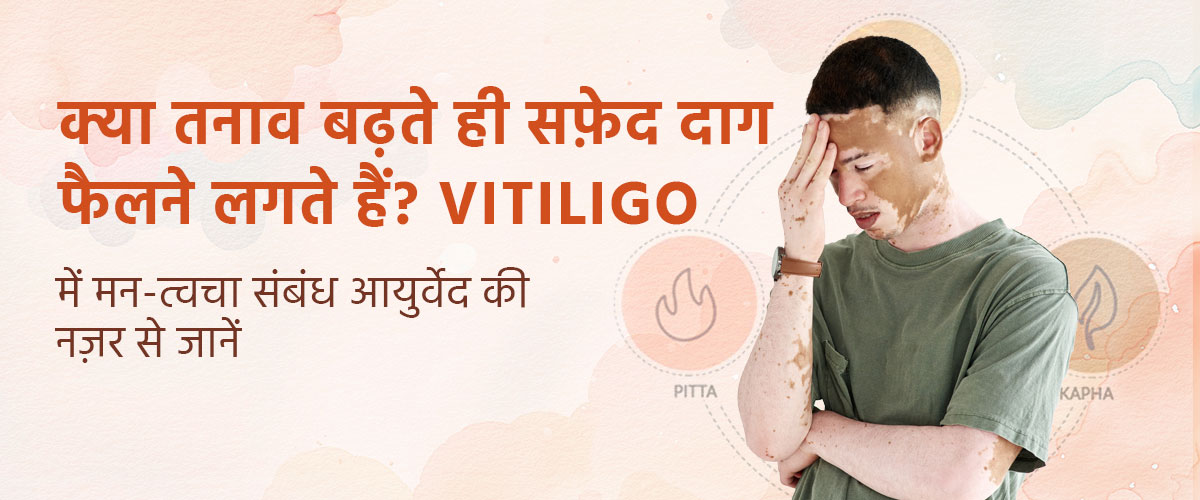 क्या तनाव बढ़ते ही सफ़ेद दाग फैलने लगते हैं? Vitiligo में मन-त्वचा संबंध आयुर्वेद की नज़र से जानें