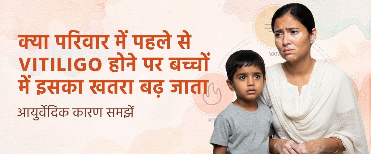 क्या परिवार में पहले से Vitiligo होने पर बच्चों में इसका खतरा बढ़ जाता है? आयुर्वेदिक कारण समझें