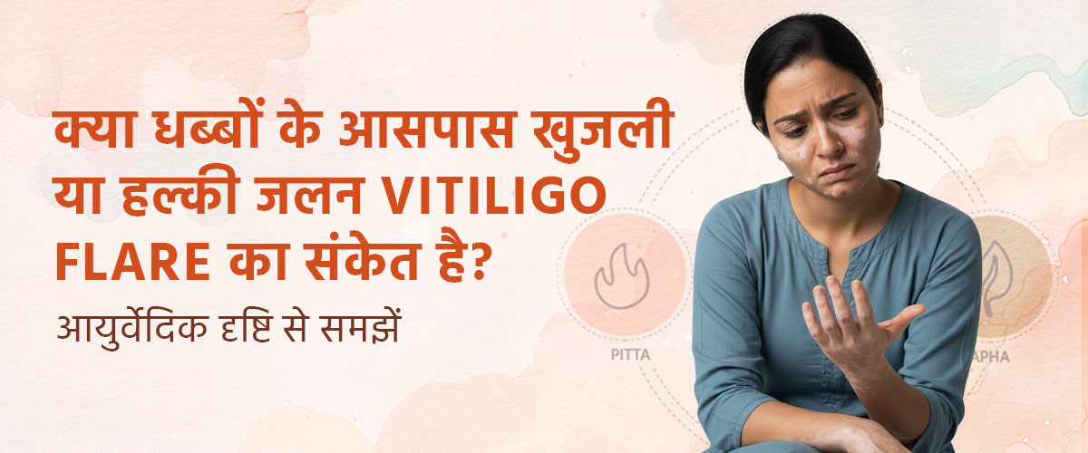 क्या धब्बों के आसपास खुजली या हल्की जलन Vitiligo flare का संकेत है? आयुर्वेदिक दृष्टि से समझें