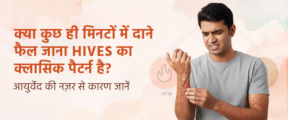 क्या कुछ ही मिनटों में दाने फैल जाना Hives का क्लासिक पैटर्न है? आयुर्वेद की नज़र से कारण जानें
