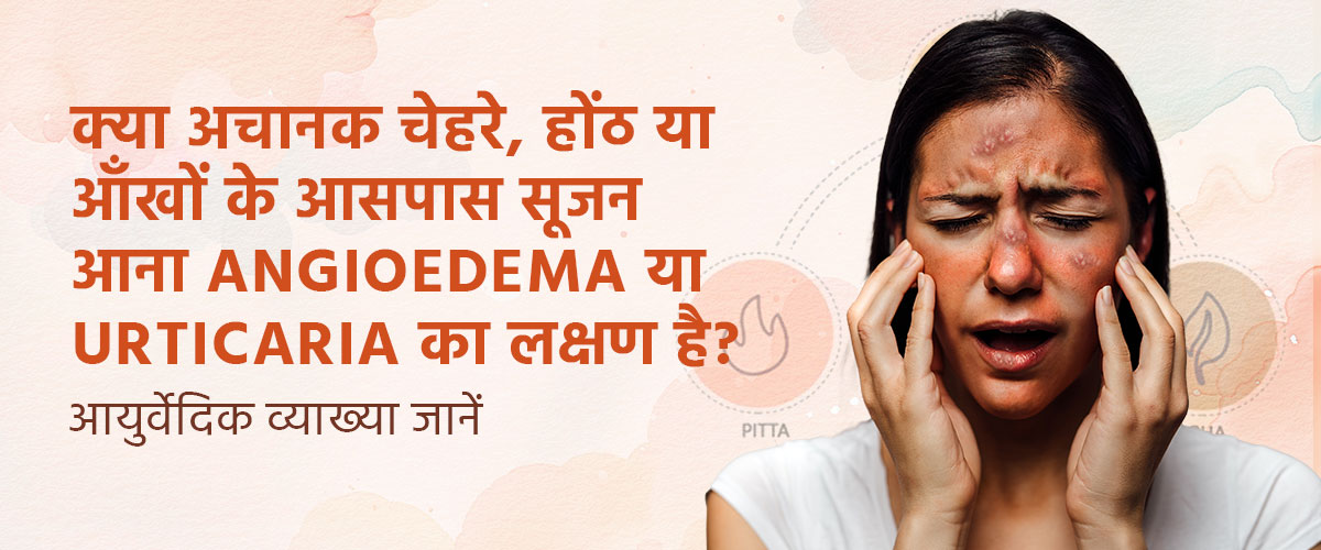 क्या अचानक चेहरे, होंठ या आँखों के आसपास सूजन आना Angioedema या Urticaria का लक्षण है? – आयुर्वेदिक व्याख्या