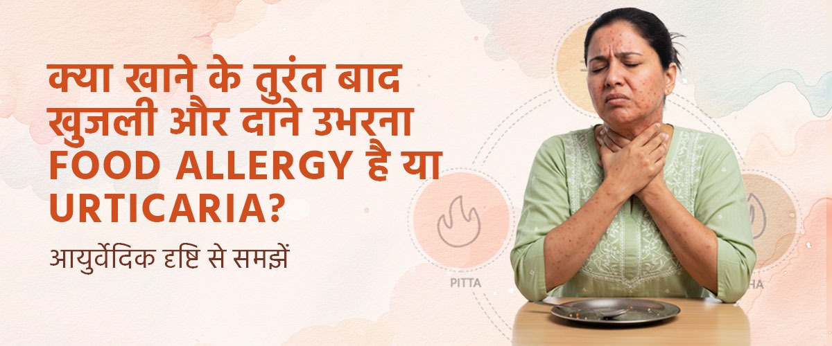 क्या खाने के तुरंत बाद खुजली और दाने उभरना Food Allergy है या Urticaria? आयुर्वेदिक दृष्टि से समझें