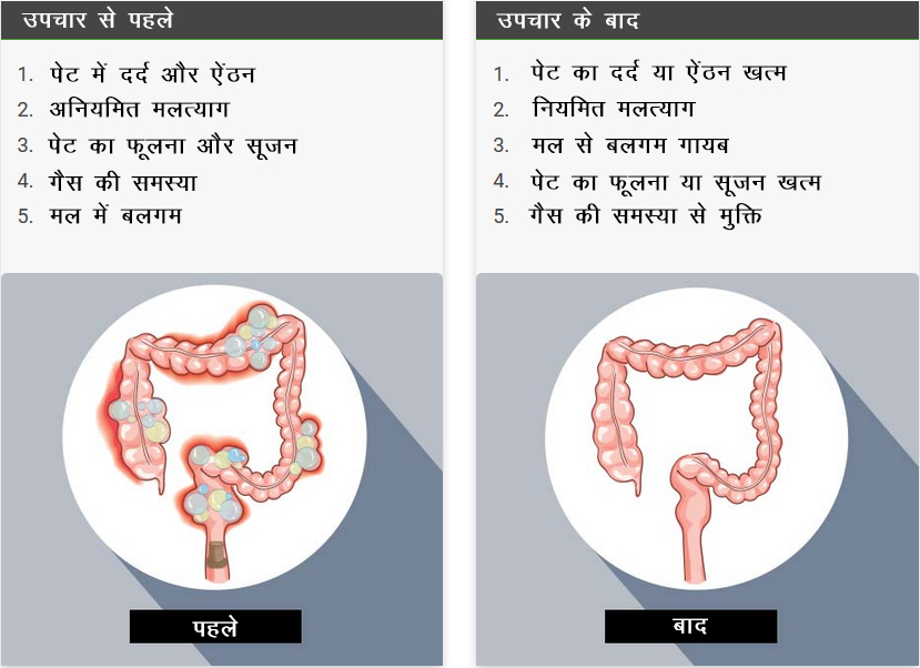 जीवा आयुर्वेद द्वारा अनियमित मलत्याग यानि ग्रहणी का 8 महीनों में इलाज