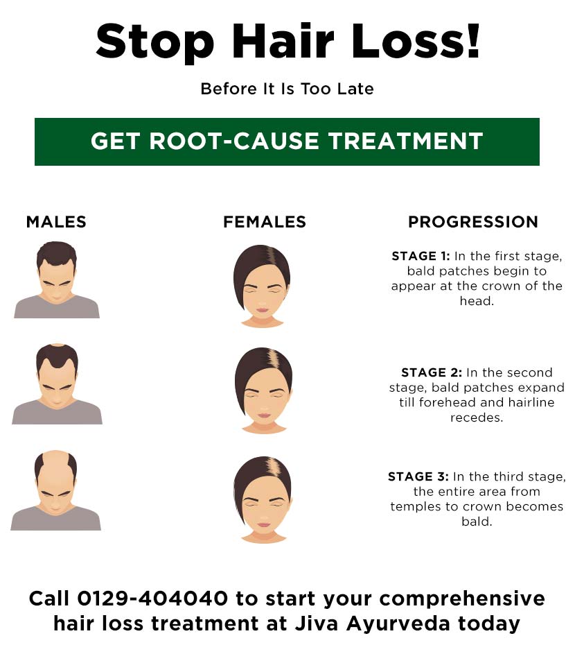 Stop Hair Loss!