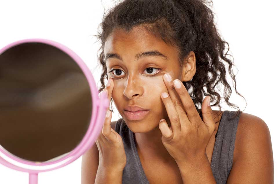 5 natural remedies to reduce dark circles