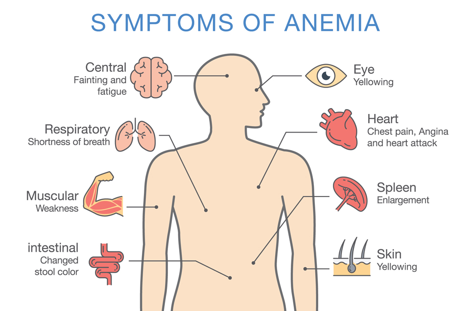 The Three Types of Anemia According to Ayurveda