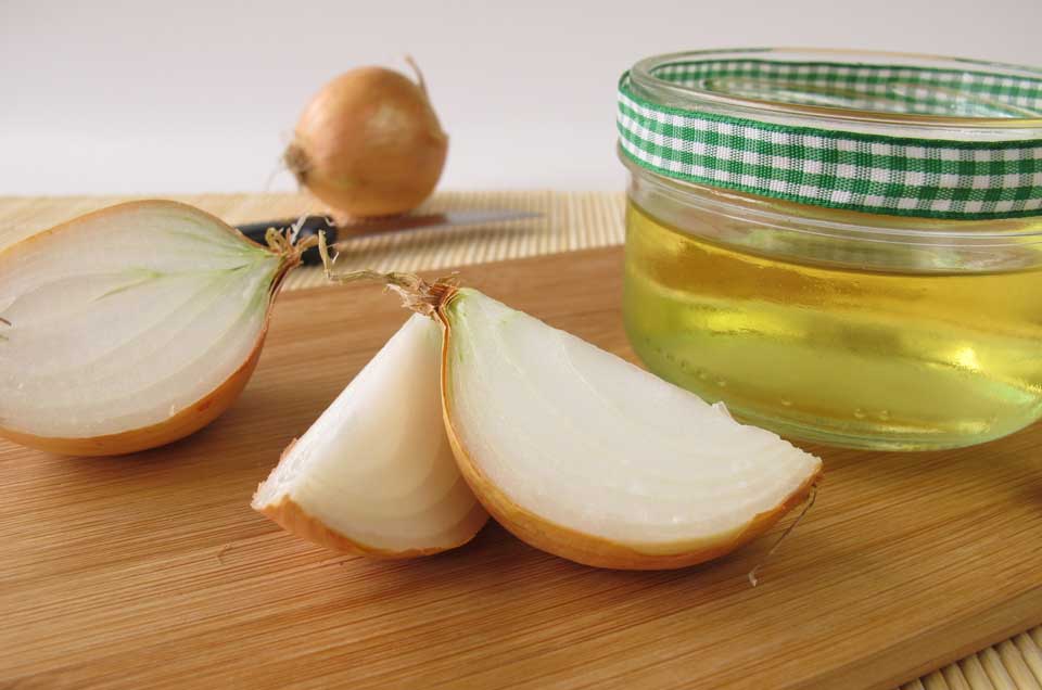 Try these onion juice remedies for hair growth