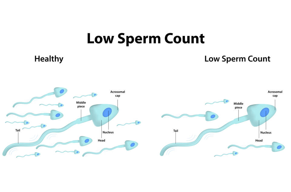 How to Increase Your Sperm Count Naturally