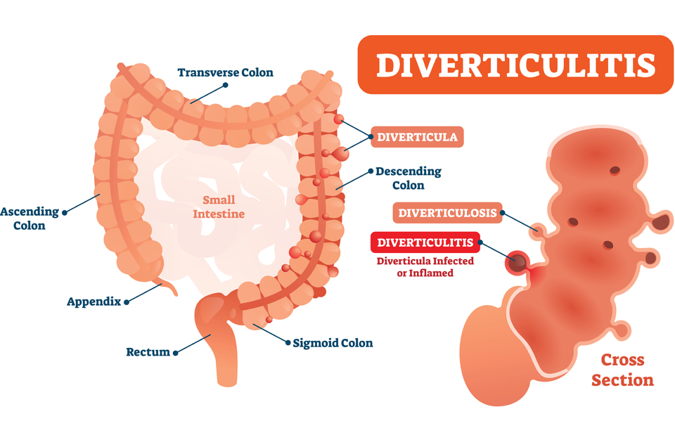 Digestive Health