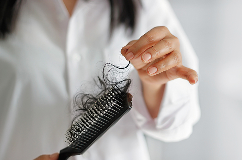 Three Rules You Should Follow to Prevent Hair Fall