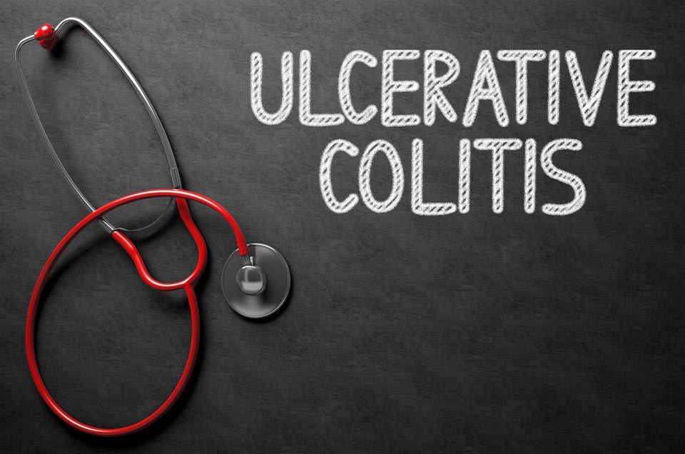 Got Stomach Cramps and Bloody Stool? You may have Ulcerative Colitis