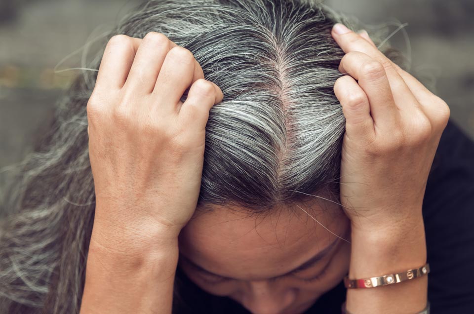 5 Natural Remedies Against Hair Loss and Premature Graying