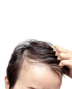 7 Ayurvedic Medicine for Hair Loss & Regrowth: Herbal Remedies